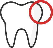 白くなるケース
