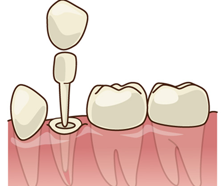 白くなるケース