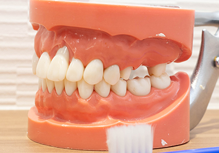 歯並びや噛み合わせ