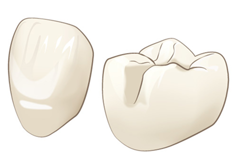 白くなるケース