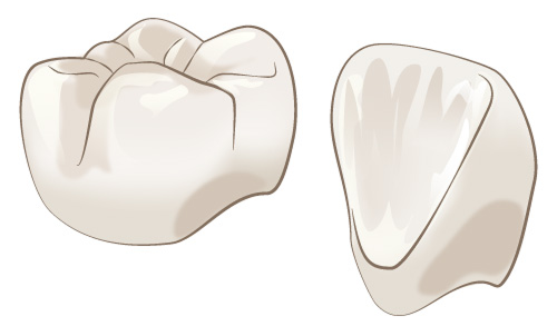 白くなるケース