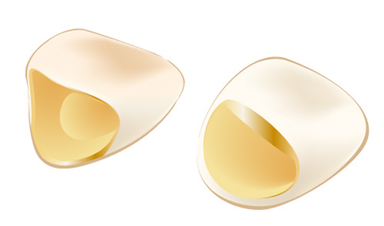 白くなるケース