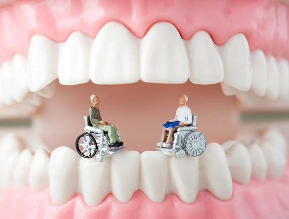 予防歯科のメリット